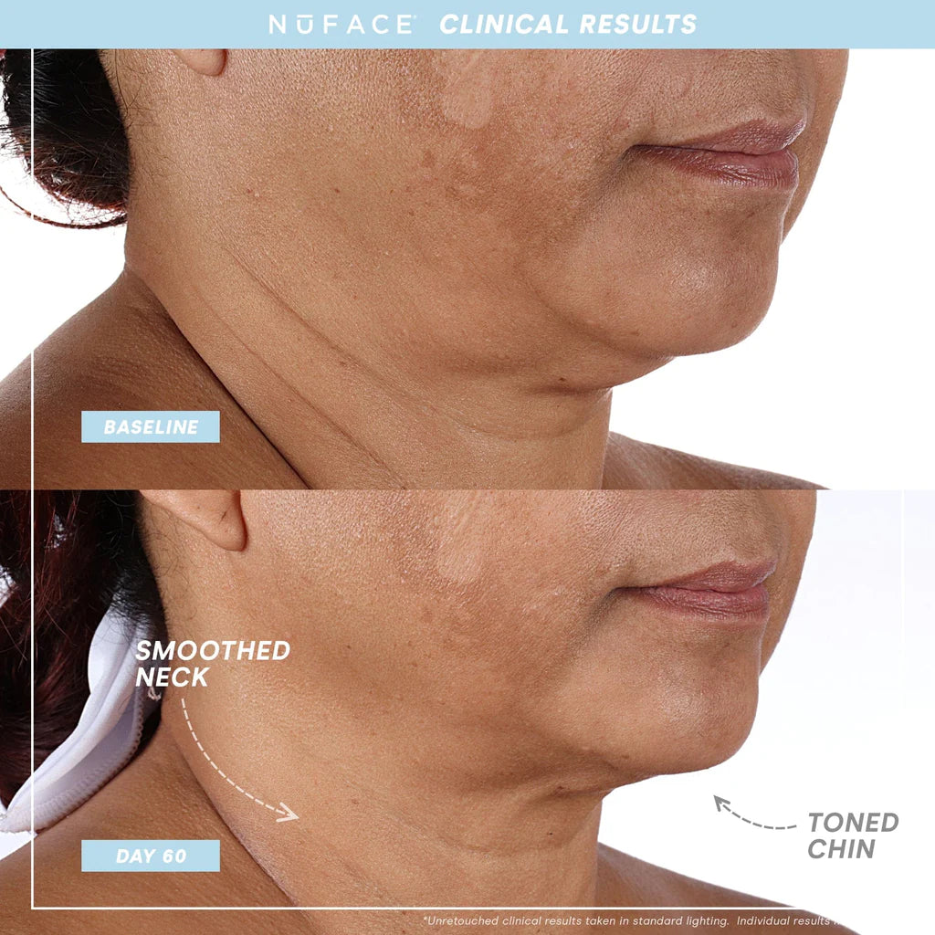 Trinity+ Pro Smart Advanced Facial Toning Kit